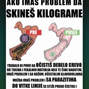 Ilustracija koja prikazuje razliku pre i posle čišćenja debelog creva – prirodna detoksikacija i podrška zdravlju creva uz Prim Rose